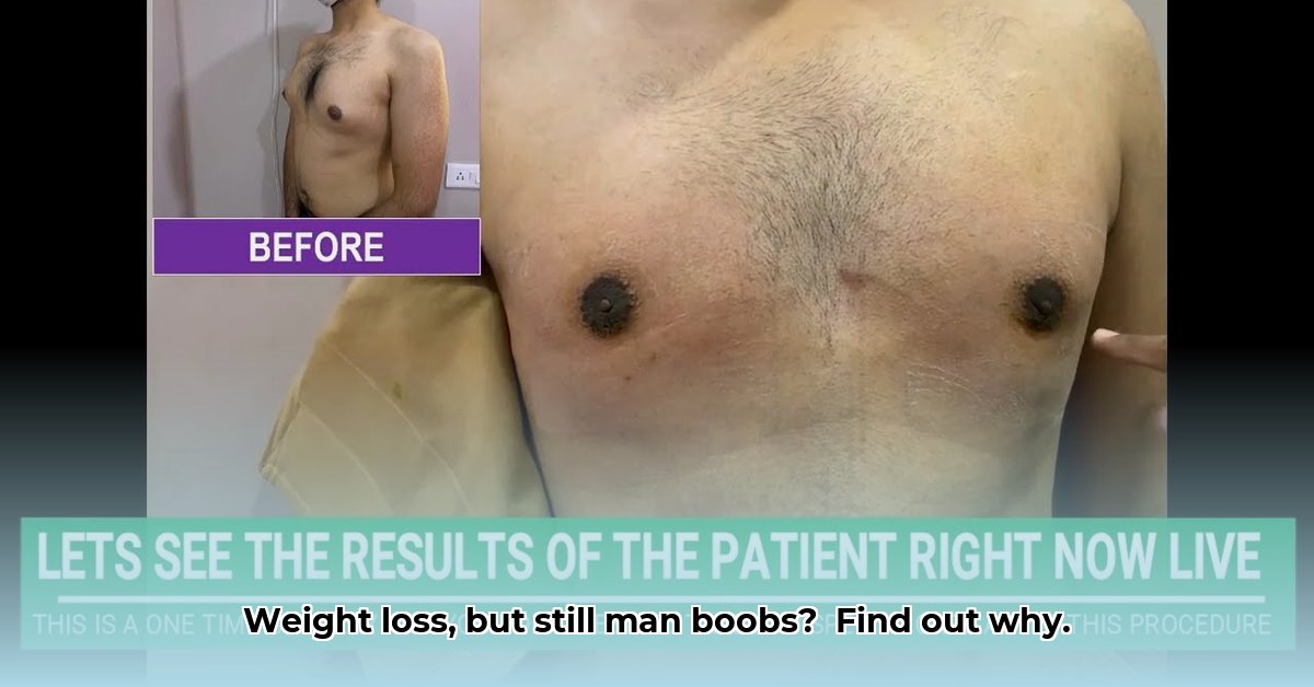 gynecomastia-after-weight-loss